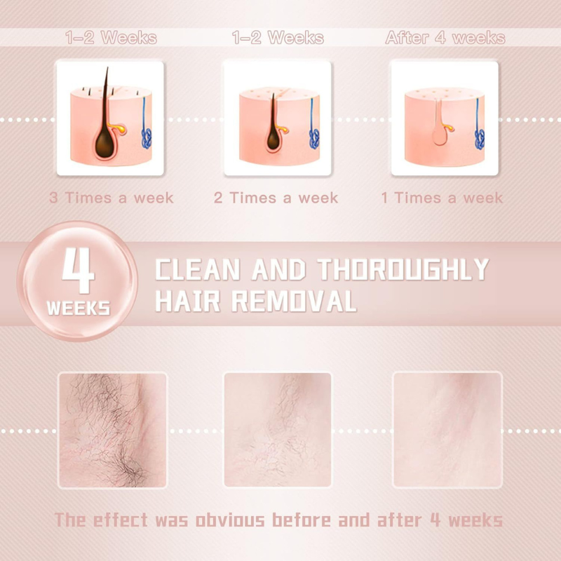 Permanent Hair Reduction Device At Home