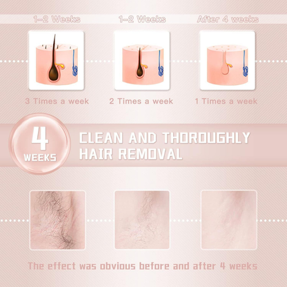 Permanent Hair Reduction Device At Home